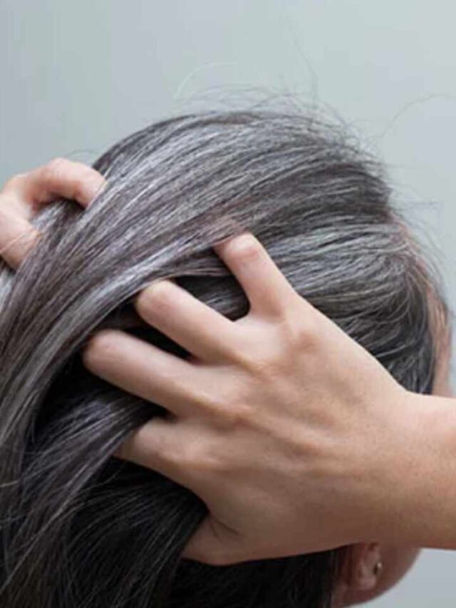 5 Effective Home Remedies For Grey Hair!